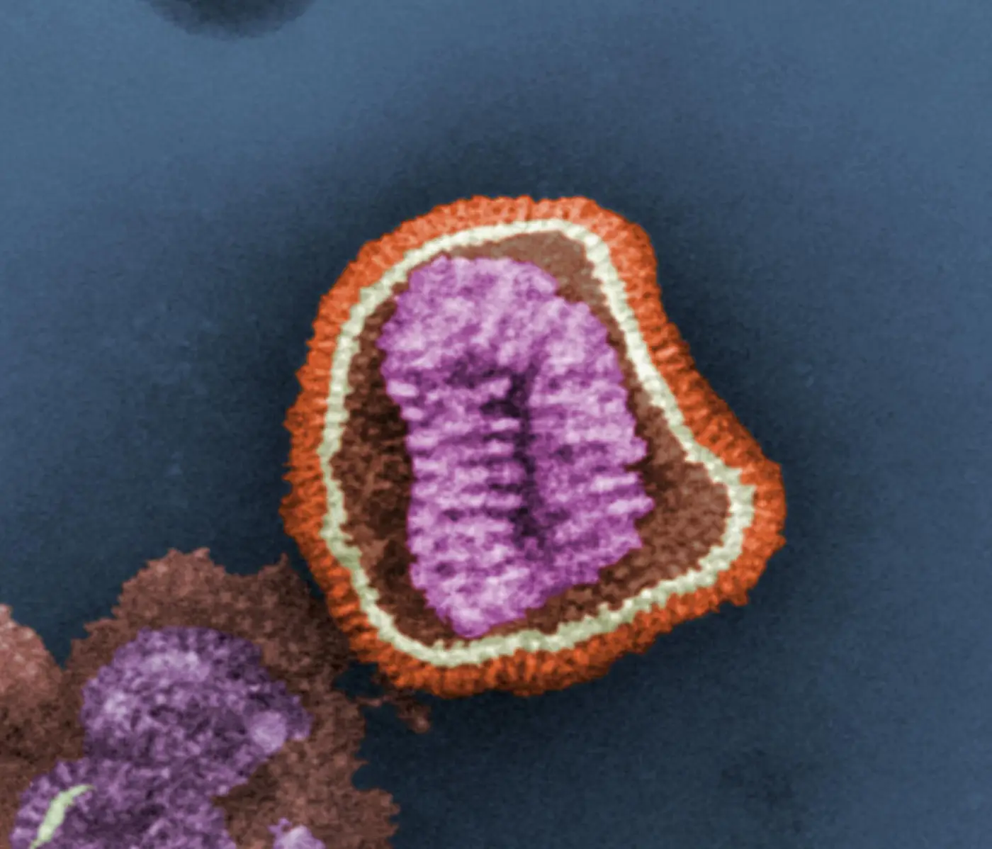 Gripe porcina (H1N1) · la primera pandemia del siglo