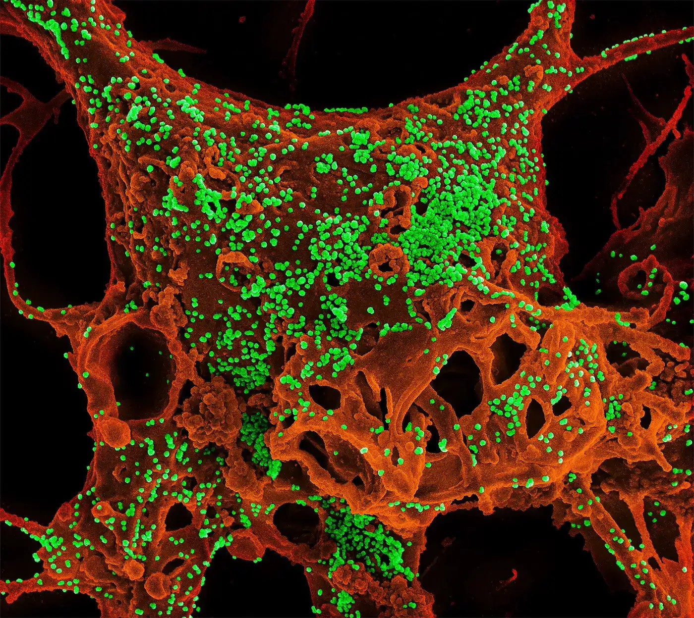MERS-CoV · el coronavirus que mata a uno de cada tres