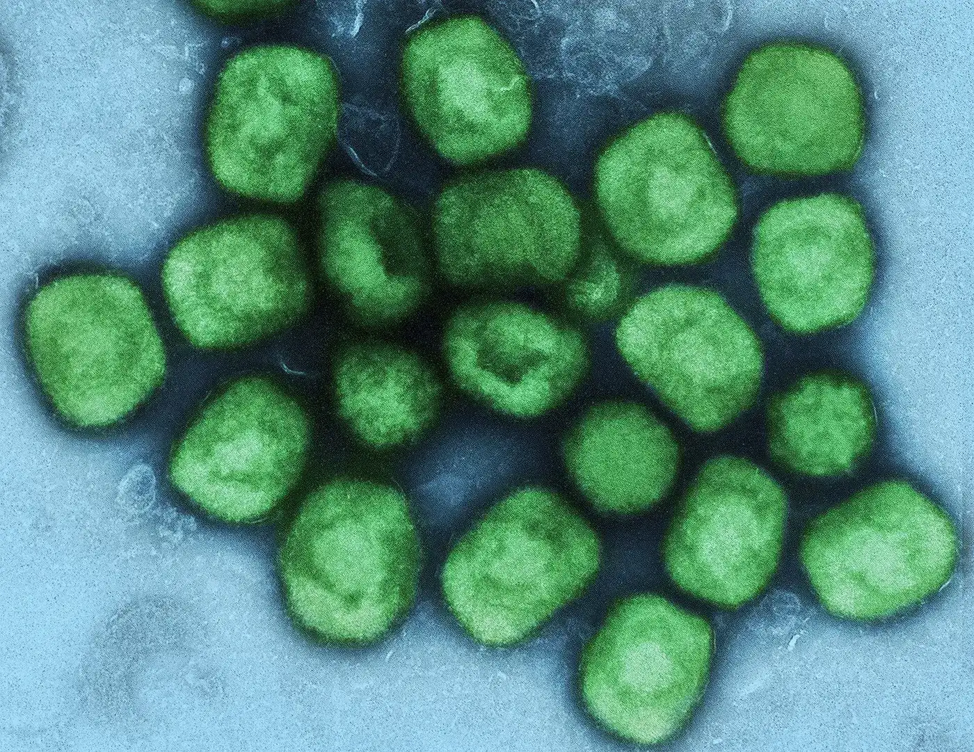 Mpox (viruela símica) · dos emergencias en tres años